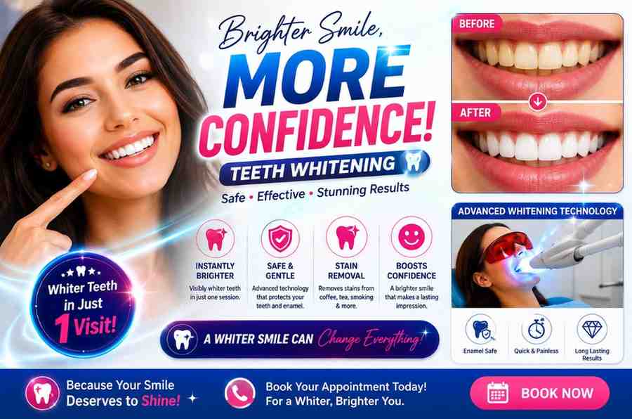 Teeth Whitening service at Orchid Dental Clinic Barasat