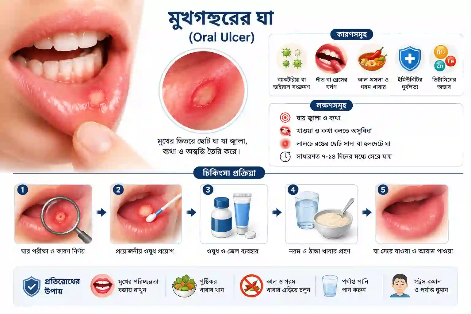 মুখগহ্বরের ঘা (Oral Ulcer) service at Orchid Dental Clinic