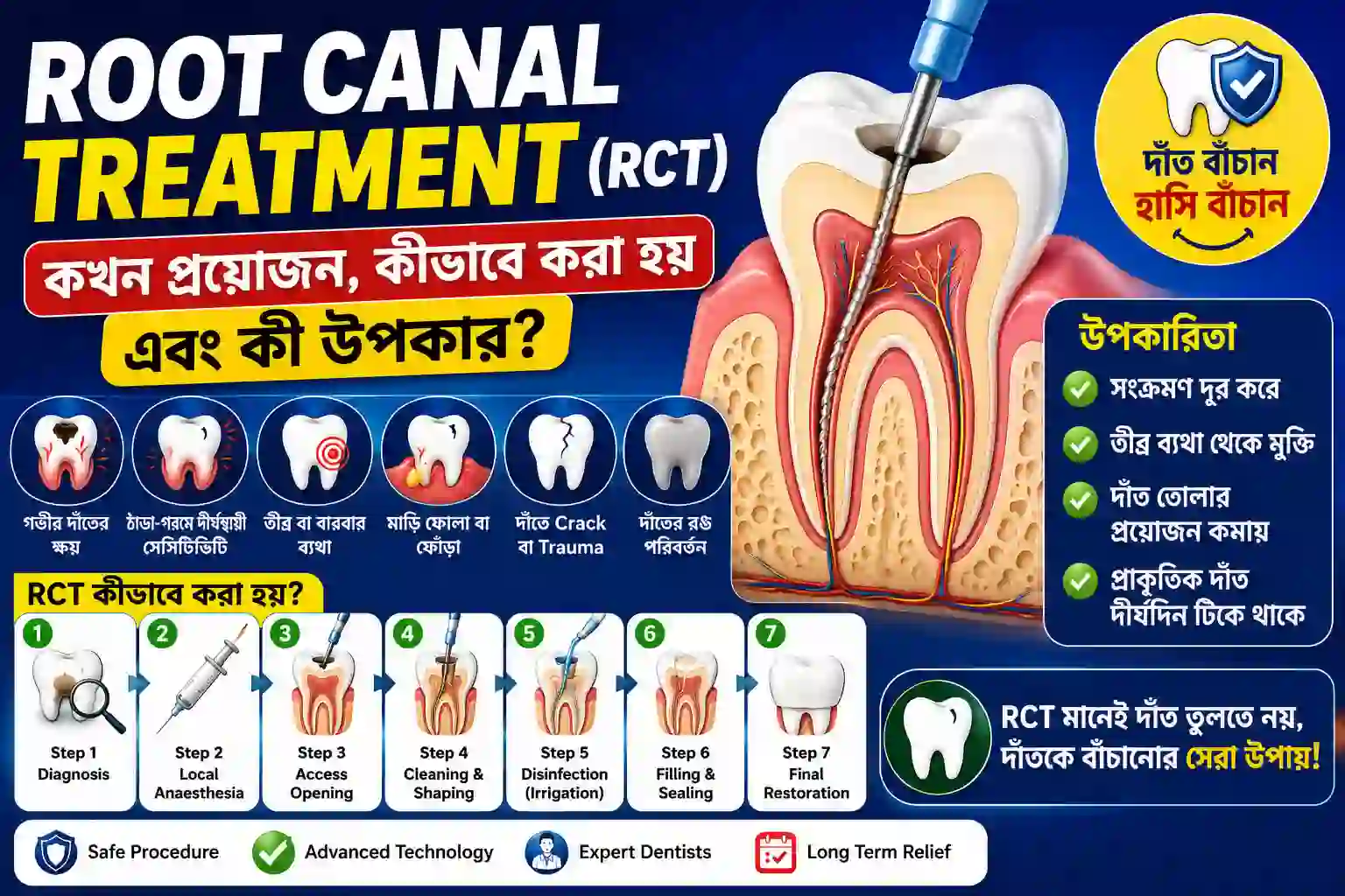 🦷 Root Canal Treatment (RCT): কখন প্রয়োজন, কীভাবে করা হয় এবং কী উপকার?