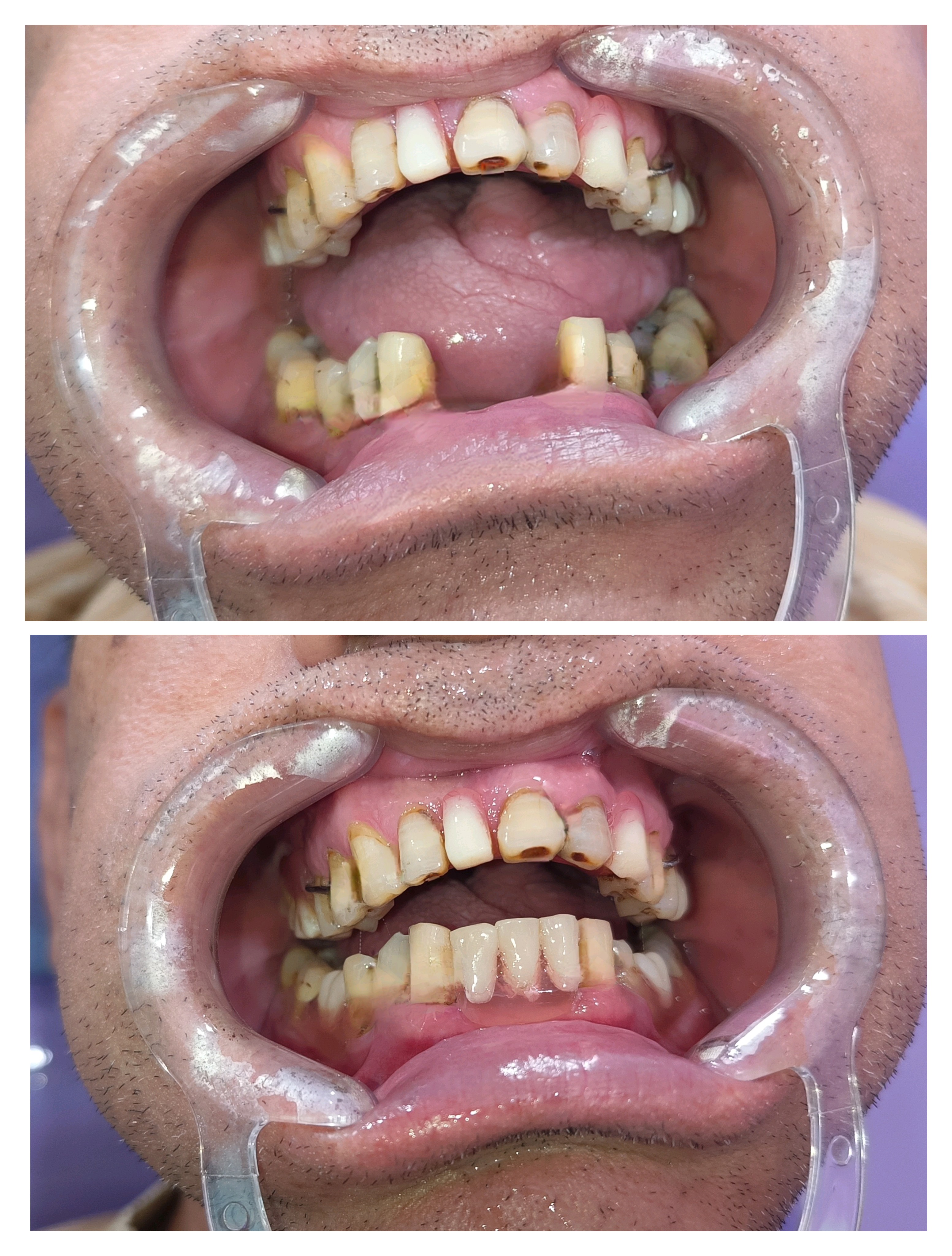 PROSTHETIC REHABILITATION dental clinic gallery photo