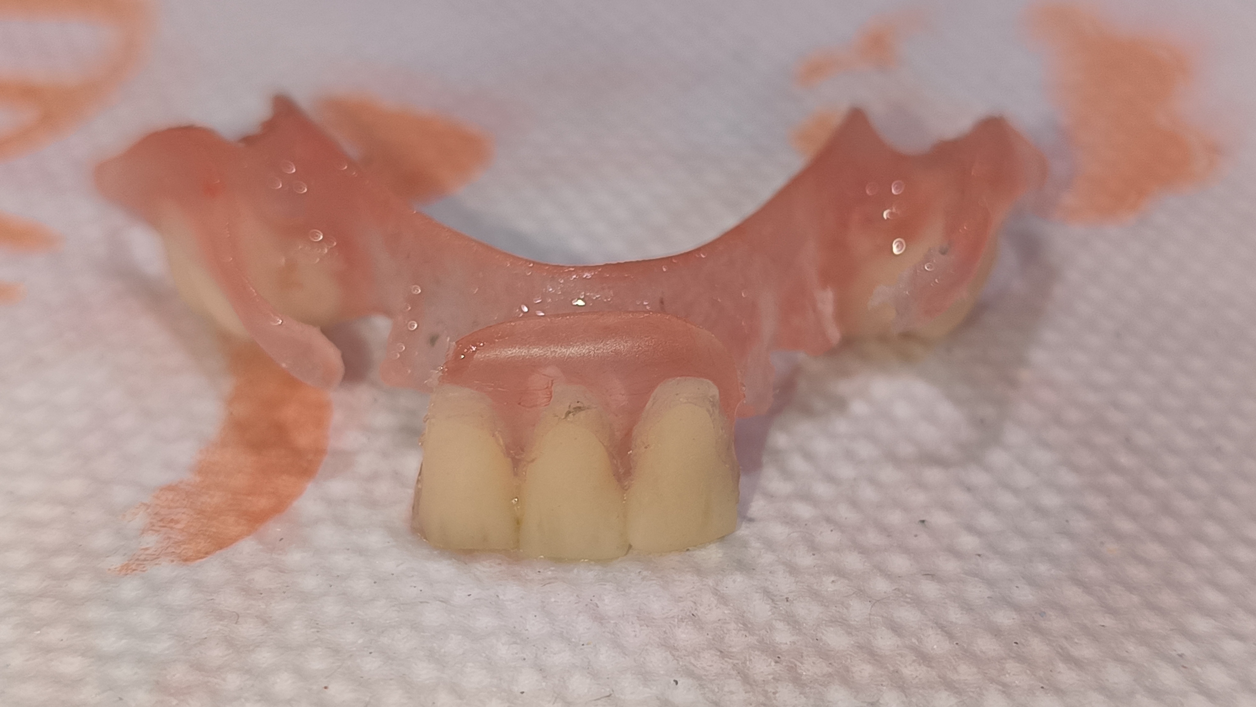 PROSTHETIC REHABILITATION dental clinic gallery photo