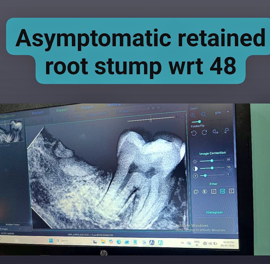 Digital Dental X-ray Facility to diagnose.