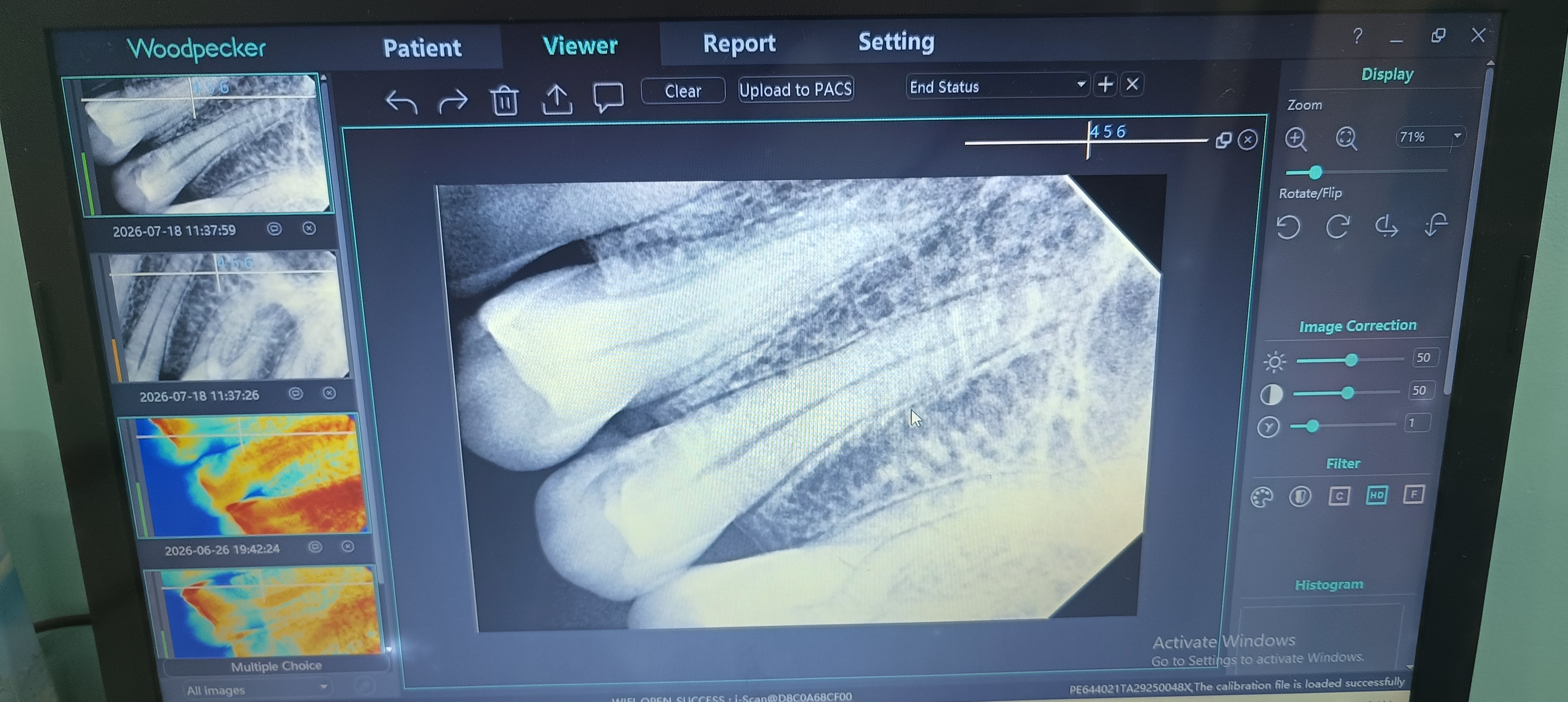 Digital Dental X-ray to better diagnosis. - RVG dental clinic photo